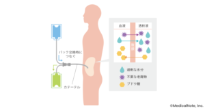 腹膜透析を行う手順とは？ ～導入前に必要なことや自分で …